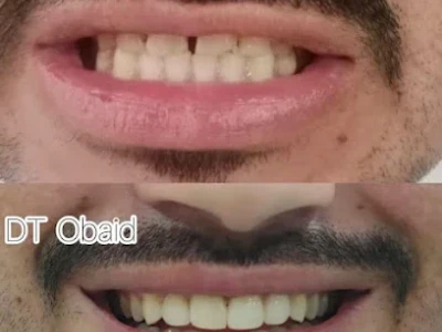 Aesthetic digital dental lab